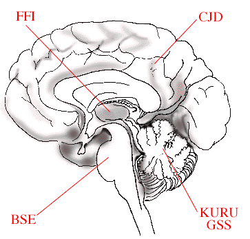 Differnt parts of the brain affected